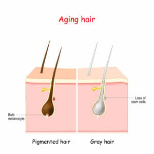 The Relationship Between Hydrogen Peroxide, Catalase and Gray Hair